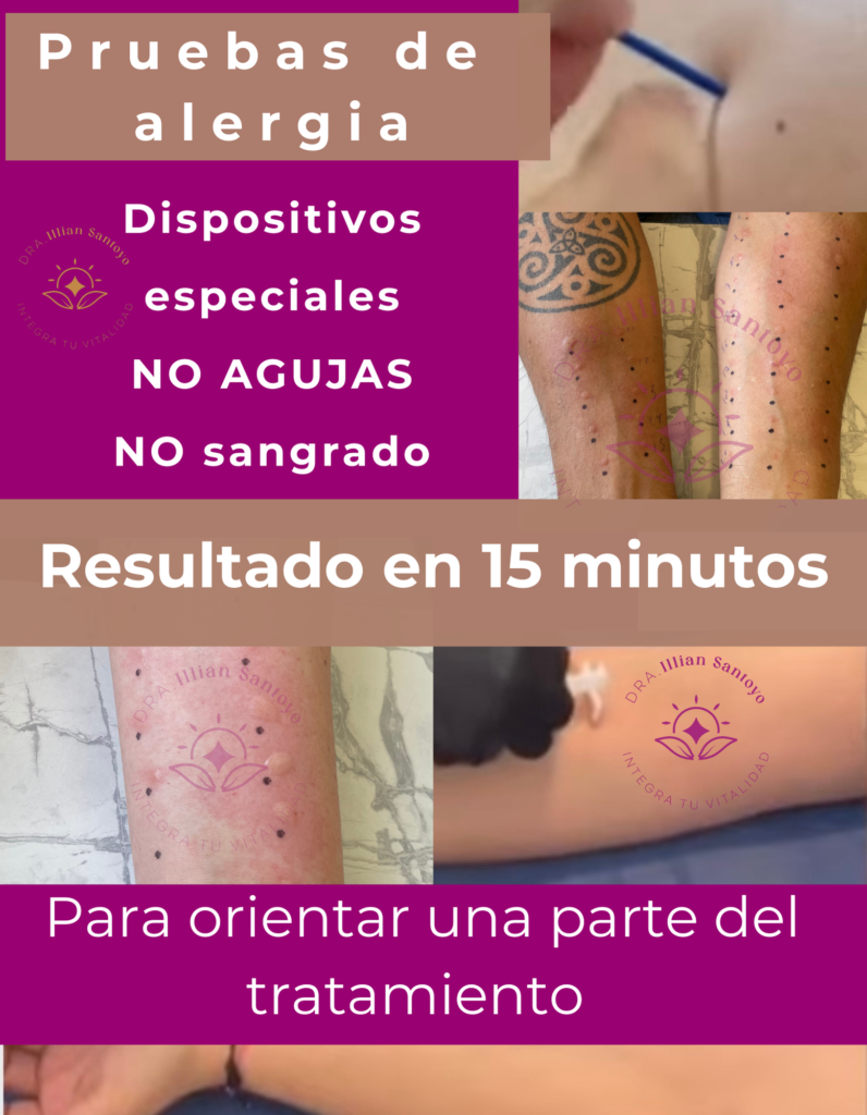 pruebas de alergia